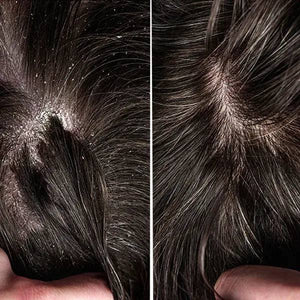 Conaturals - Scalp Comfort Shampoo for Men 250Ml - My Store