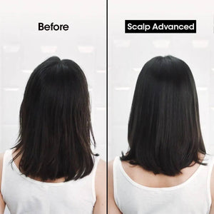 L'Oreal Professional - Serie Expert Scalp Advance Shampoo 300 ML - For Anti Dandruff - My Store
