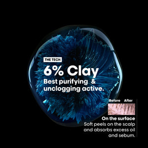 L'Oreal Professional - Serie Expert Scalp Advance Shampoo 300 ML - For Oily Scalp - My Store