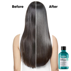 L'Oreal Professional - Serie Expert Scalp Advance Shampoo 300 ML - For Oily Scalp - My Store