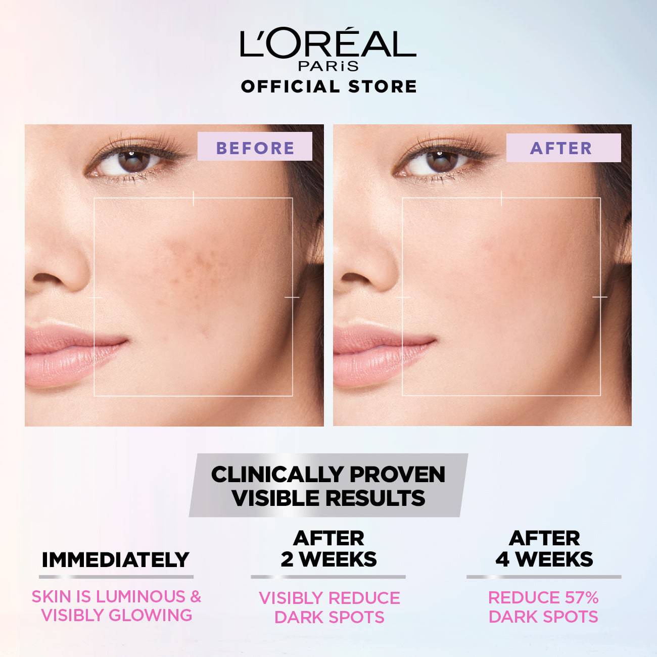 L'Oreal Paris Glycolic Bright Glowing Daily Face Wash 100ml - My Store