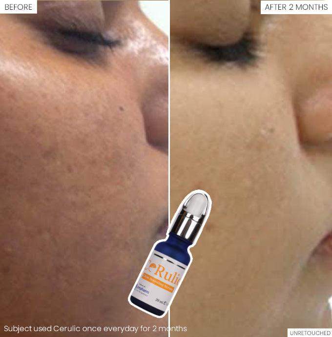 Jenpharm Cerulic Glow Boosting Serum 20Ml
