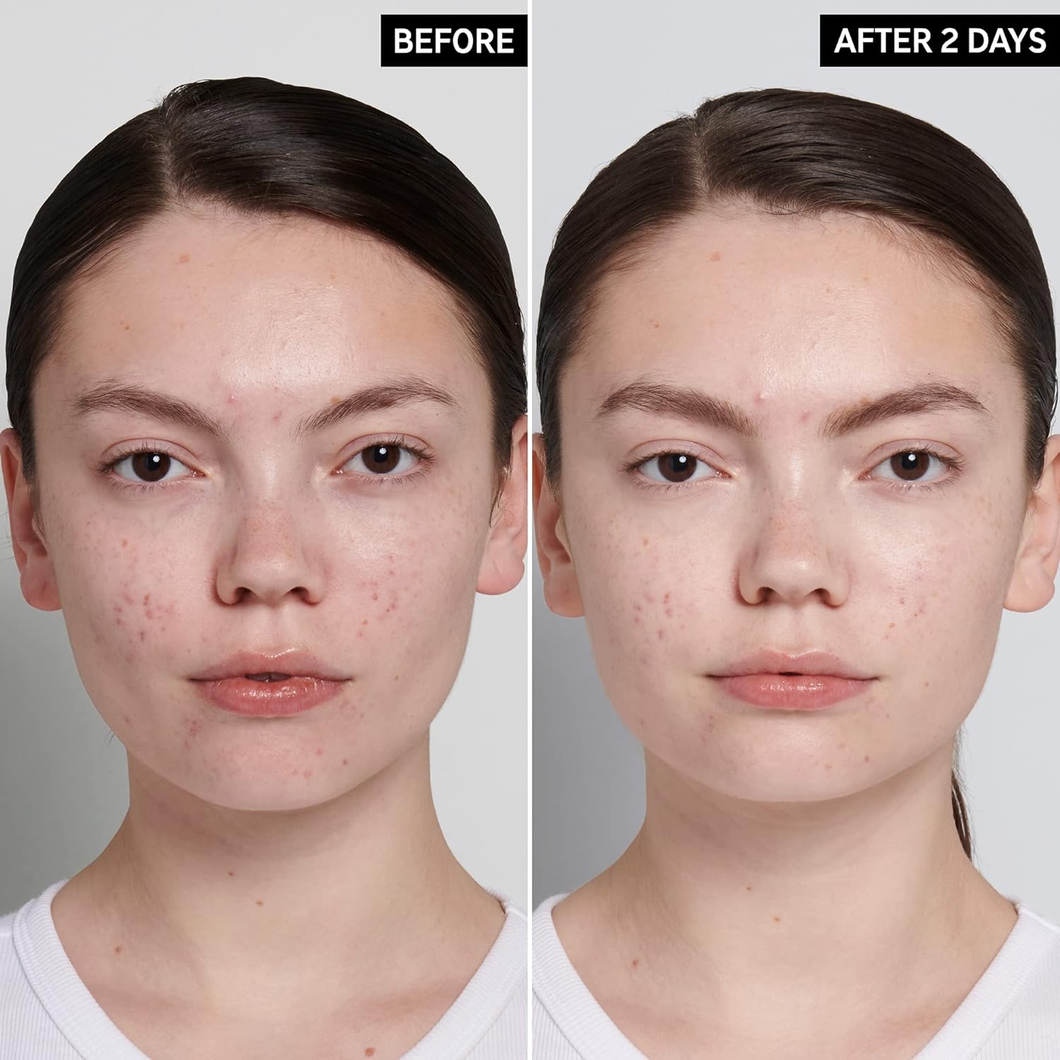 The Inkey List Succinic Acid Treatment  Serum 15Ml