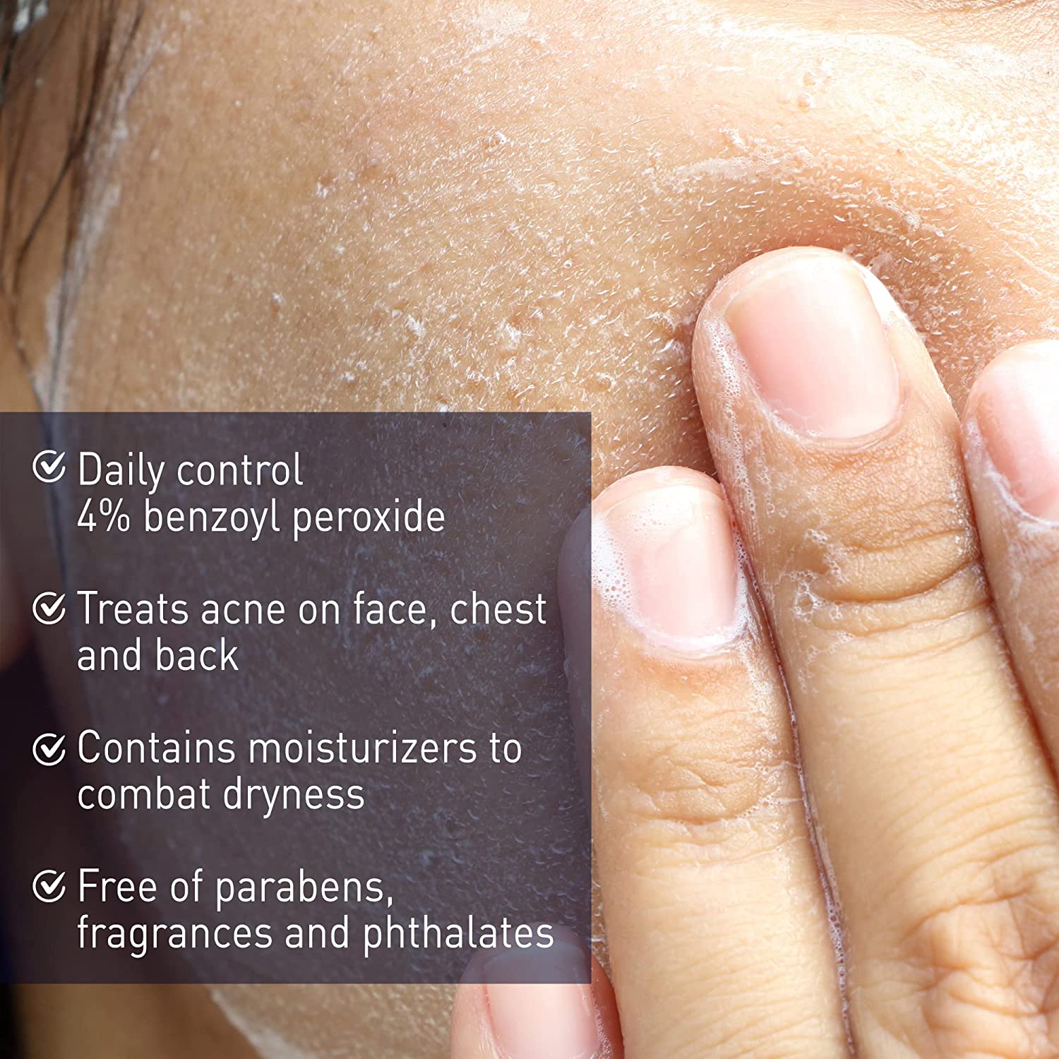 Panoxyl Benzoyl Peroxide 4% Daily Control Acne Creamy Wash 6 Oz (170G)