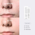 Skin1004 Madagascar Centella Tone Brightening Capsule Ampoule-100Ml