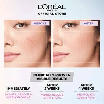 Bundle - L'Oreal Paris Glycolic Bright Instant Glowing Face Serum - 30Ml + L'Oreal Paris Revitalift 1.5% Hyaluronic Acid Face Serum 30 Ml - My Store
