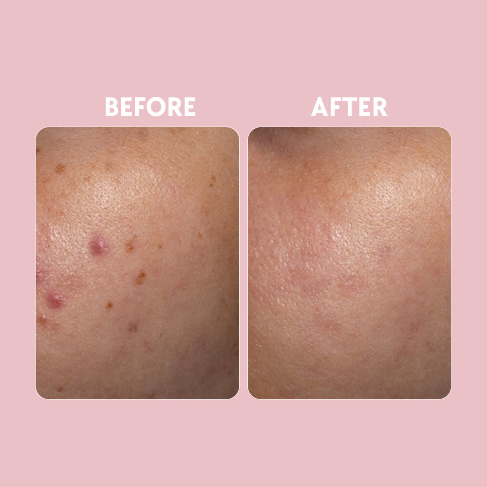 Posch - Vitamin C Brightening Serum 30ml