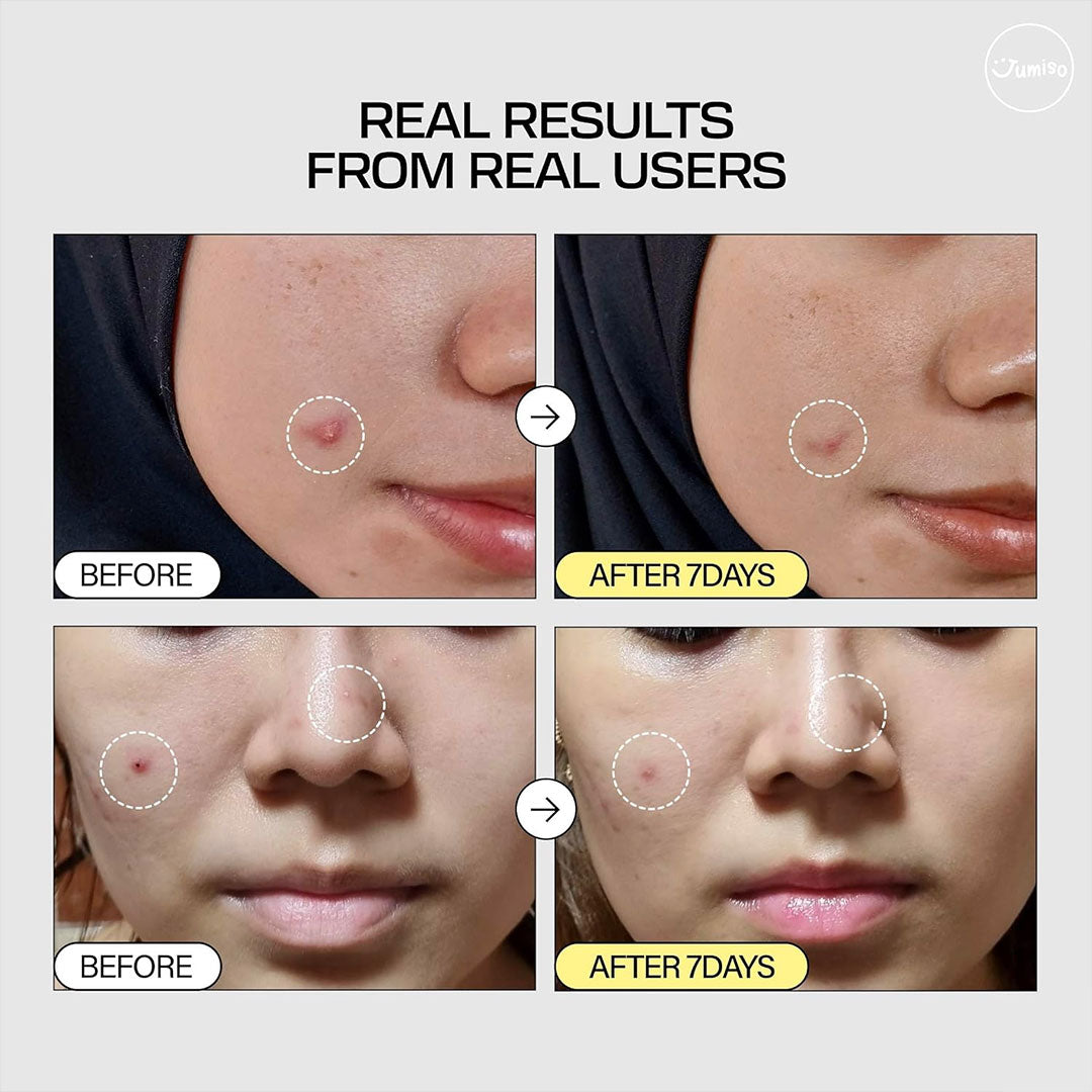 Jumiso Snail Mucin 95+ Peptide Facial Essence - 140ml