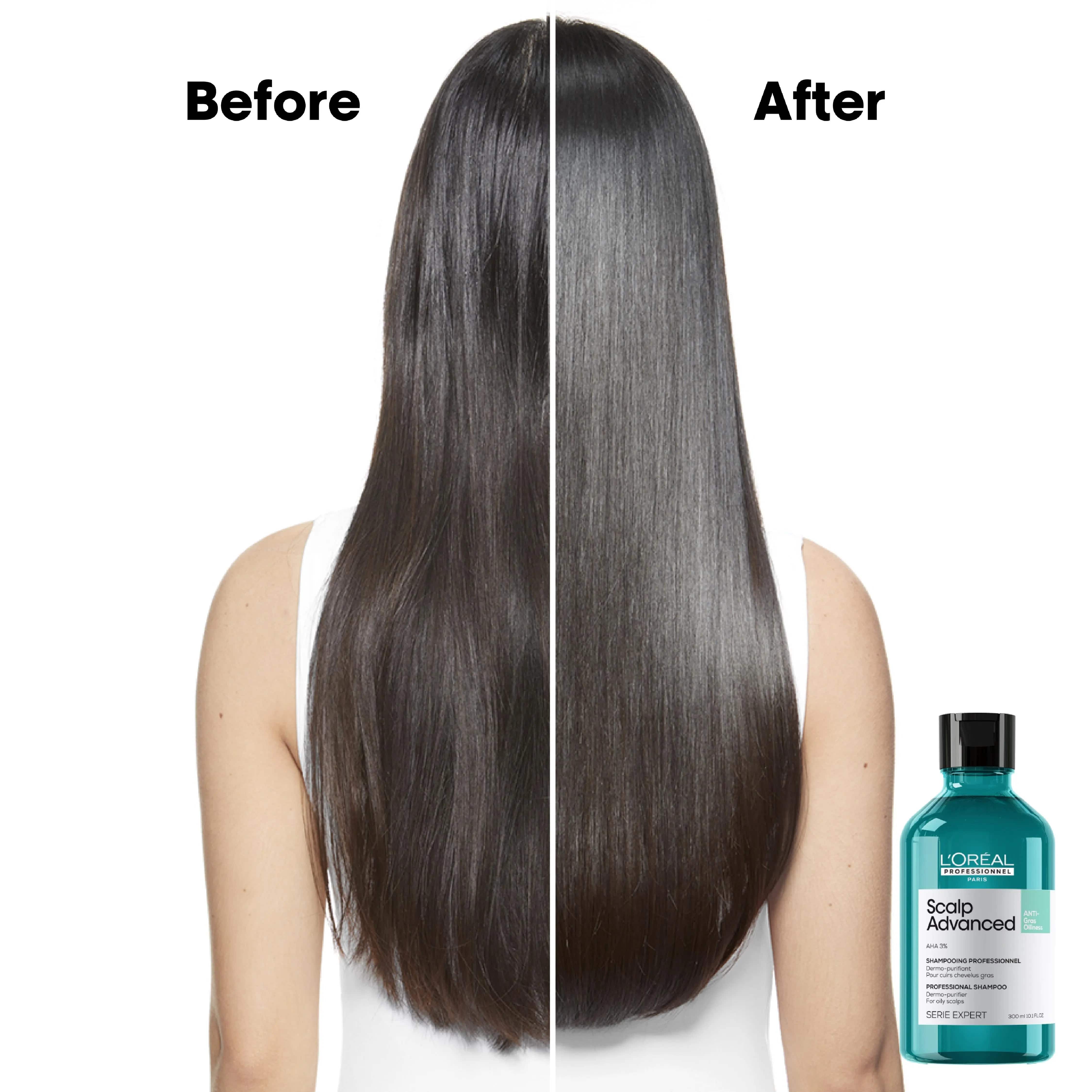 L'Oreal Professional - Serie Expert Scalp Advance Shampoo 300 ML - For Oily Scalp - My Store