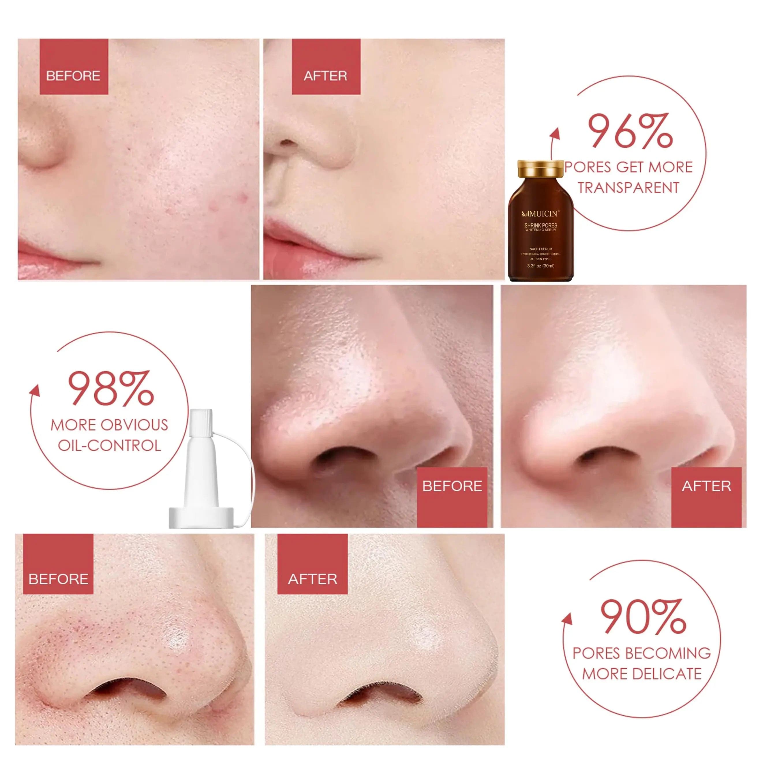 MUICIN - Shrink Pores Hyaluronic Acid Serum - 30ml - My Store