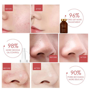 MUICIN - Shrink Pores Hyaluronic Acid Serum - 30ml - My Store