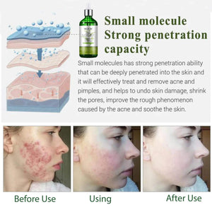 MUICIN - Tea Tree Anti Aging Clear Skin Face Serum - 100ml - My Store
