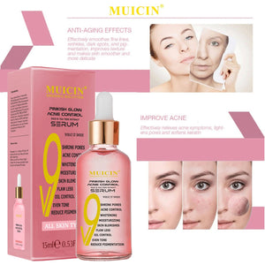 MUICIN - V9 Pinkish Glow Anti Acne Face Serum - 15ml - My Store