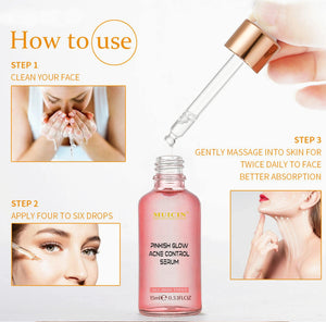 MUICIN - V9 Pinkish Glow Anti Acne Face Serum - 15ml - My Store