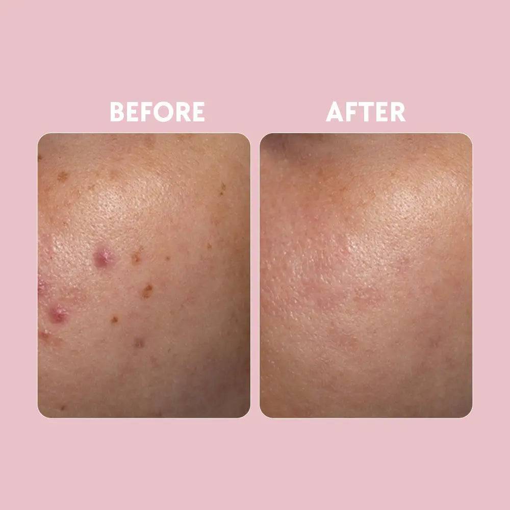 Posch - Vitamin C Brightening Serum 30ml - My Store