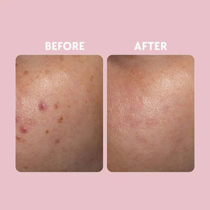 Posch - Vitamin C Brightening Serum 30ml - My Store