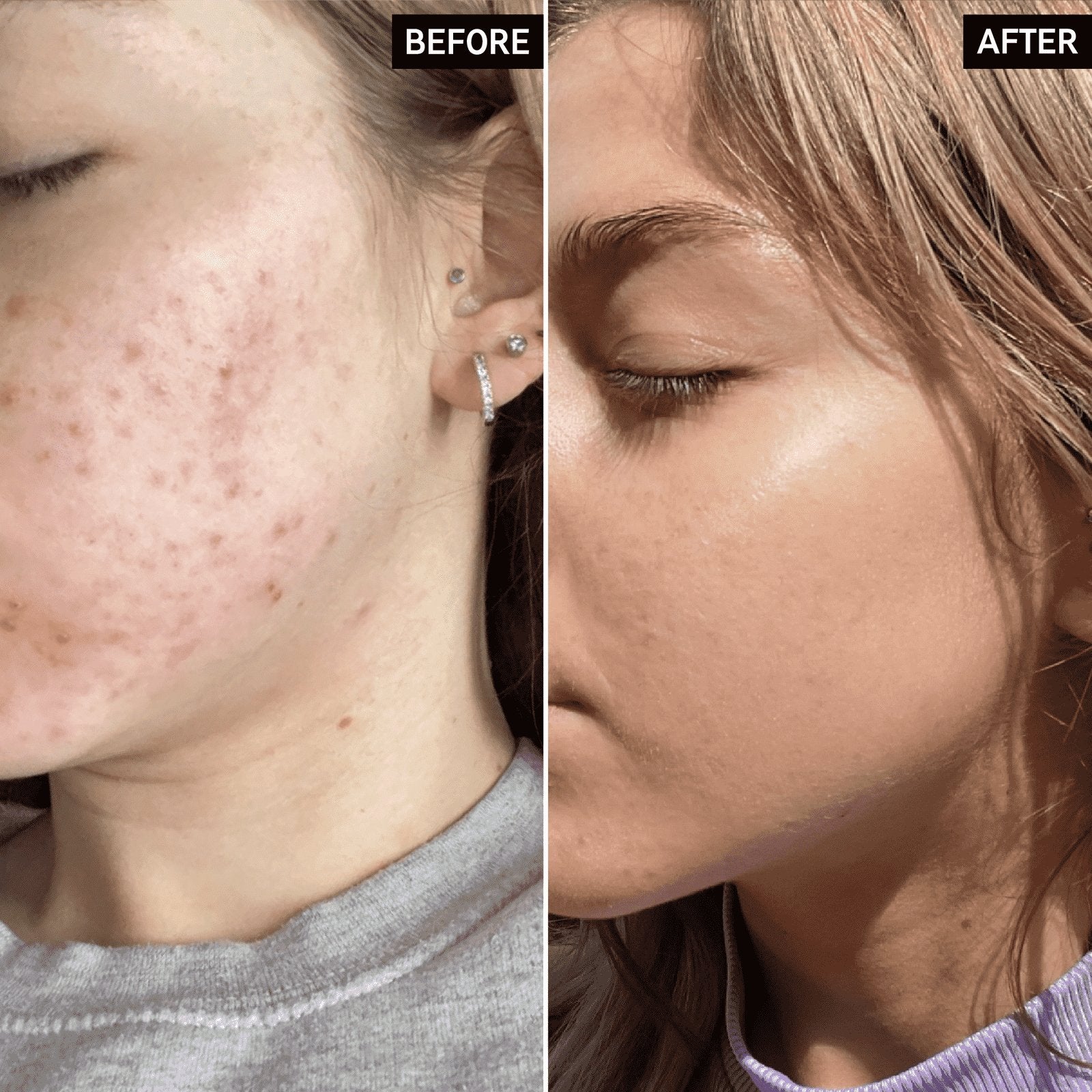 The Inkey List Niacinamide Serum 30Ml